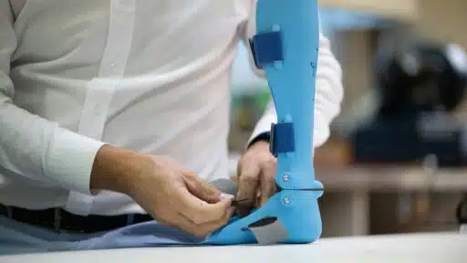 Prosthetic Limb