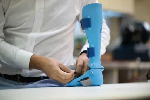 Prosthetic Limb