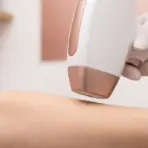 Laser hair removal device applied to forearm in spa setting