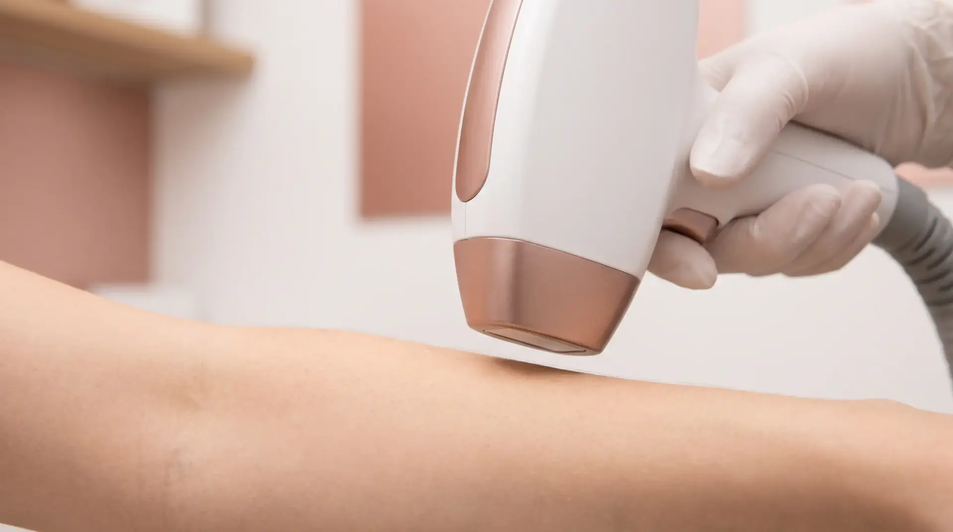 Laser hair removal device applied to forearm in spa setting